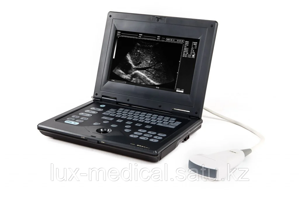 Портативный УЗИ сканер AcuVista RS880c
