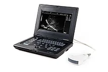 Портативный УЗИ сканер AcuVista RS880c